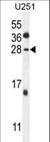 GGTLC2 Antibody - GGTLC2 Antibody western blot of U251 cell line lysates (35 ug/lane). The GGTLC2 antibody detected the GGTLC2 protein (arrow).