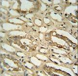 GGTLC2 Antibody - GGTLC2 antibody immunohistochemistry of formalin-fixed and paraffin-embedded human lung tissue followed by peroxidase-conjugated secondary antibody and DAB staining.