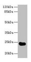 GGTLC2 Antibody - Western blot All lanes: GGTLC2 antibody at 2µg/ml + Mouse kidney tissue Secondary Goat polyclonal to rabbit IgG at 1/10000 dilution Predicted band size: 24 kDa Observed band size: 24 kDa