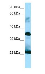 GH / Growth Hormone Antibody - GH / Growth Hormone antibody Western Blot of Fetal Small Intestine.  This image was taken for the unconjugated form of this product. Other forms have not been tested.