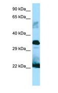 GH / Growth Hormone Antibody - GH / Growth Hormone antibody Western Blot of Fetal Small Intestine.  This image was taken for the unconjugated form of this product. Other forms have not been tested.