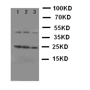 GH / Growth Hormone Antibody - WB of GH / Growth Hormone antibody. Lane 1: Recombinant Rat GH Protein 10ng. Lane 2: Recombinant Rat GH Protein 5ng. Lane 3: Recombinant Rat GH Protein 2.5ng.