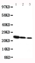 GH / Growth Hormone Antibody - Anti-rat Growth Hormone antibody, Western blotting Lane 1: Recombinant Rat GH Protein 10ng Lane 2: Recombinant Rat GH Protein 5ng Lane 3: Recombinant Rat GH Protein 2