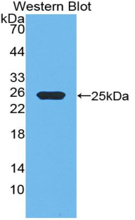 GH / Growth Hormone Antibody - Western blot of GH / Growth Hormone antibody.