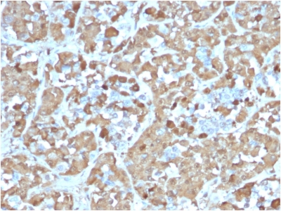 GH / Growth Hormone Antibody - Formalin-fixed, paraffin-embedded Human Pituitary stained with Growth Hormone Recombinant Mouse Monoclonal Antibody (rGH/1450).