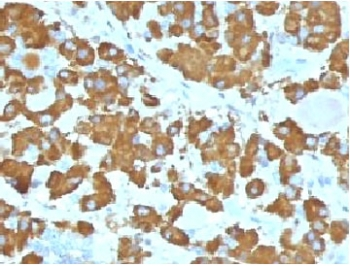 GH / Growth Hormone Antibody - IHC testing of FFPE human pituitary gland with Growth Hormone antibody (clone GRHP1-1). Required HIER: boil tissue sections in 10mM citrate buffer, pH 6, for 10-20 min.