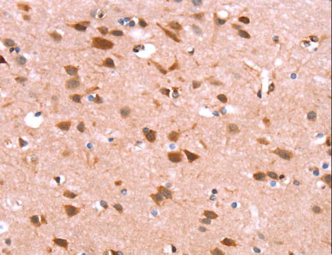 GH / Growth Hormone Antibody - Immunohistochemistry of paraffin-embedded Human brain using GH1 Polyclonal Antibody at dilution of 1:40.