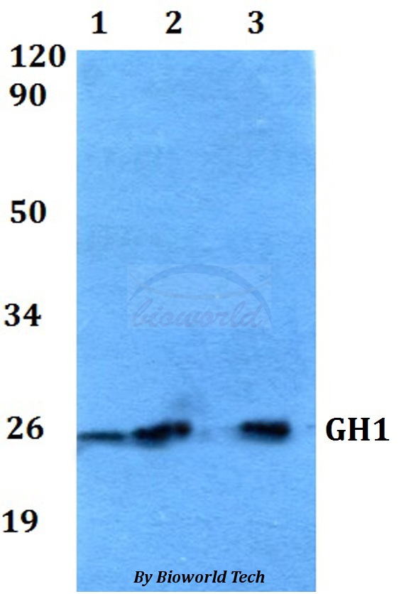 GH / Growth Hormone Antibody - Western blot of GH1 antibody at 1:500 dilution. Lane 1: HEK293T whole cell lysate. Lane 2: sp2/0 whole cell lysate. Lane 3: PC12 whole cell lysate.