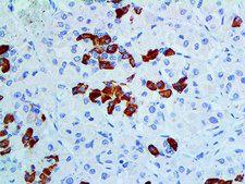 GH / Growth Hormone Antibody - IHC of GH on a FFPE Pituitary Tissue