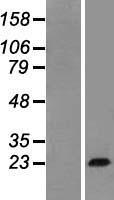 GH / Growth Hormone Protein - Western validation with an anti-DDK antibody * L: Control HEK293 lysate R: Over-expression lysate