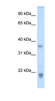 GH2 Antibody - GH2 antibody ARP42013_T100-NP_072050-GH2(growth hormone 2) Antibody Western blot of Placenta lysate.  This image was taken for the unconjugated form of this product. Other forms have not been tested.