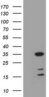 GH2 Antibody - HEK293T cells were transfected with the pCMV6-ENTRY control. (Left lane) or pCMV6-ENTRY GH2. (Right lane) cDNA for 48 hrs and lysed. Equivalent amounts of cell lysates. (5 ug per lane) were separated by SDS-PAGE and immunoblotted with anti-GH2. (1:2000)