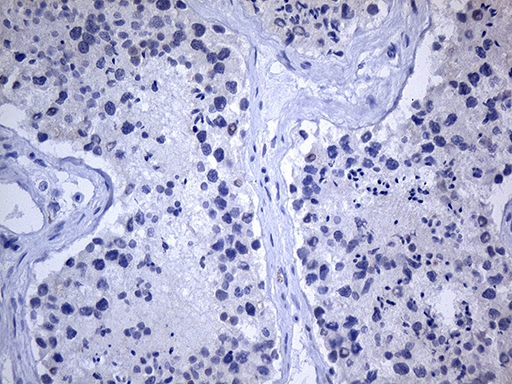 GH2 Antibody - Immunohistochemical staining of paraffin-embedded Human testicle tissue within the normal limits using anti-GH2 mouse monoclonal antibody. This figure shows negative stainning. (Heat-induced epitope retrieval by 1mM EDTA in 10mM Tris buffer. (pH8.5) at 120°C for 3 min. (1:500)