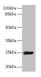 GH2 Antibody - Western blot All lanes: GH2 antibody at 16µg/ml + Mouse skeletal muscle tissue Secondary Goat polyclonal to rabbit IgG at 1/10000 dilution Predicted band size: 26, 29, 24, 28 kDa Observed band size: 26 kDa