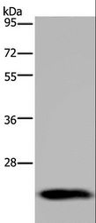 GH2 Antibody - Western blot analysis of Human placenta tissue, using GH2 Polyclonal Antibody at dilution of 1:700.