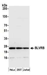 GHBP / BLVRB Antibody - Detection of human BLVRB by western blot. Samples: Whole cell lysate (50 µg) from HeLa, HEK293T, and Jurkat cells prepared using NETN lysis buffer. Antibody: Affinity purified rabbit anti-BLVRB antibody used for WB at 0.1 µg/ml. Detection: Chemiluminescence with an exposure time of 10 seconds.