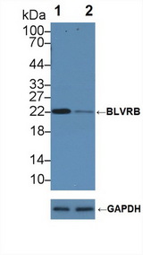 GHBP / BLVRB Antibody - Knockout Varification: Lane 1: Wild-type Hela cell lysate; Lane 2: BLVRB knockout Hela cell lysate; Predicted MW: 22kd Observed MW: 22kd Primary Ab: 1µg/ml Rabbit Anti-Human BLVRB Antibody Second Ab: 0.2µg/mL HRP-Linked Caprine Anti-Rabbit IgG Polyclonal Antibody