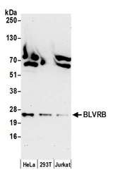 GHBP / BLVRB Antibody - Detection of human BLVRB by western blot. Samples: Whole cell lysate (50 µg) from HeLa, HEK293T, and Jurkat cells prepared using NETN lysis buffer. Antibody: Affinity purified rabbit anti-BLVRB antibody used for WB at 0.1 µg/ml. Detection: Chemiluminescence with an exposure time of 30 seconds.