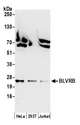 GHBP / BLVRB Antibody - Detection of human BLVRB by western blot. Samples: Whole cell lysate (50 µg) from HeLa, HEK293T, and Jurkat cells prepared using NETN lysis buffer. Antibody: Affinity purified rabbit anti-BLVRB antibody used for WB at 0.1 µg/ml. Detection: Chemiluminescence with an exposure time of 30 seconds.