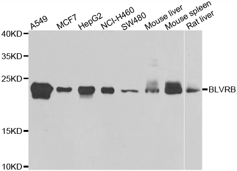 GHBP / BLVRB Antibody - Western blot analysis of extracts of various cell lines.