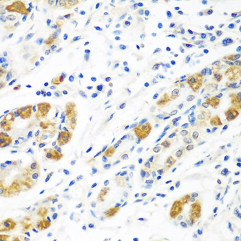 GHBP / BLVRB Antibody - Immunohistochemistry of paraffin-embedded human stomach tissue.