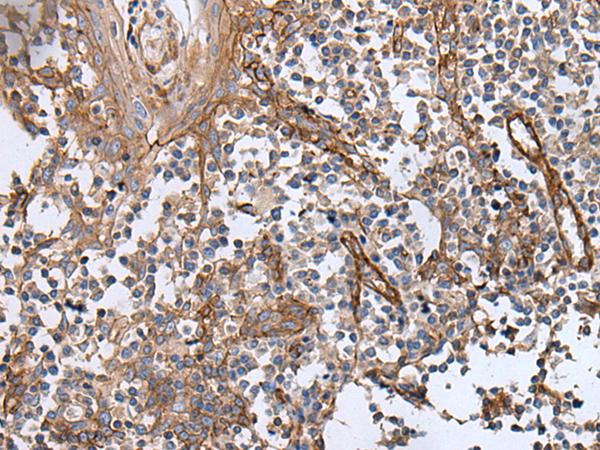 GHBP / BLVRB Antibody - Immunohistochemistry of paraffin-embedded Human tonsil tissue  using BLVRB Polyclonal Antibody at dilution of 1:65(×200)