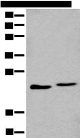 GHBP / BLVRB Antibody - Western blot analysis of A549 and K562 cell lysate  using BLVRB Polyclonal Antibody at dilution of 1:600