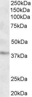 GHITM Antibody - Goat Anti-MICS1 / GHITM (aa117-127) Antibody (2µg/ml) staining of Human Cerebral Cortex lysate (35µg protein in RIPA buffer). Primary incubation was 1 hour. Detected by chemiluminescencence.