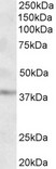 GHITM Antibody - Goat Anti-MICS1 / GHITM (aa117-127) Antibody (2µg/ml) staining of Human Cerebral Cortex lysate (35µg protein in RIPA buffer). Primary incubation was 1 hour. Detected by chemiluminescencence.