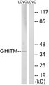 GHITM Antibody - Western blot analysis of lysates from LOVO cells, using GHITM Antibody. The lane on the right is blocked with the synthesized peptide.