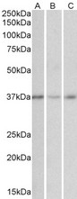 GHITM Antibody - Goat Anti-MICS1 / GHITM Antibody (0.01µg/ml) staining of Human Cerebellum (A), Duodenum (B) and Heart (C) cell lysates (35µg protein in RIPA buffer). Primary incubation was 1 hour. Detected by chemiluminescencence.