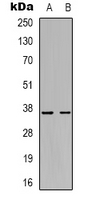 GHITM Antibody - Western blot analysis of GHITM expression in HeLa (A); Ramos (B) whole cell lysates.