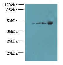 GHITM Antibody - Western blot. All lanes: GHITM antibody at 4 ug/ml. Lane 1: HeLa whole cell lysate. Lane 2: SH-SY5Y whole cell lysate. Lane 3: HepG-2 whole cell lysate. Lane 4: Mouse muscle tissue. Secondary Goat polyclonal to Rabbit IgG at 1:10000 dilution. Predicted band size: 37 kDa. Observed band size: 37 kDa.