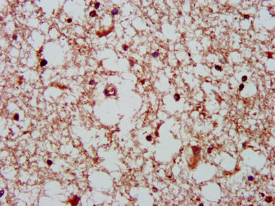 GHITM Antibody - IHC image of GHITM Antibody diluted at 1:400 and staining in paraffin-embedded human brain tissue performed on a Leica BondTM system. After dewaxing and hydration, antigen retrieval was mediated by high pressure in a citrate buffer (pH 6.0). Section was blocked with 10% normal goat serum 30min at RT. Then primary antibody (1% BSA) was incubated at 4°C overnight. The primary is detected by a biotinylated secondary antibody and visualized using an HRP conjugated SP system.