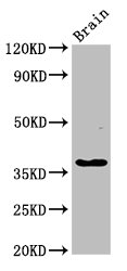 GHITM Antibody - Western Blot Positive WB detected in: Rat brain tissue All lanes: GHITM antibody at 2.7µg/ml Secondary Goat polyclonal to rabbit IgG at 1/50000 dilution Predicted band size: 38 kDa Observed band size: 38 kDa