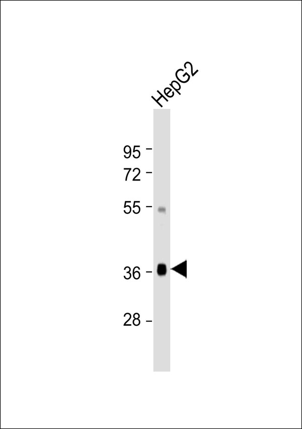 GHITM Antibody - Anti-GHITM Antibody at 1:1000 dilution + HepG2 whole cell lysate Lysates/proteins at 20 ug per lane. Secondary Goat Anti-Rabbit IgG, (H+L), Peroxidase conjugated at 1:10000 dilution. Predicted band size: 37 kDa. Blocking/Dilution buffer: 5% NFDM/TBST.