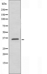 GHITM Antibody - Western blot analysis of extracts of LOVO cells using GHITM antibody.