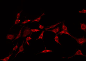 GHITM Antibody - Staining LOVO cells by IF/ICC. The samples were fixed with PFA and permeabilized in 0.1% Triton X-100, then blocked in 10% serum for 45 min at 25°C. The primary antibody was diluted at 1:200 and incubated with the sample for 1 hour at 37°C. An Alexa Fluor 594 conjugated goat anti-rabbit IgG (H+L) Ab, diluted at 1/600, was used as the secondary antibody.