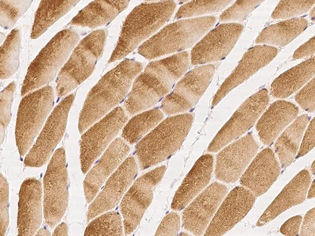 GHITM Antibody - Immunochemical staining of human GHITM in human skeletal muscle with rabbit polyclonal antibody at 1:500 dilution, formalin-fixed paraffin embedded sections.