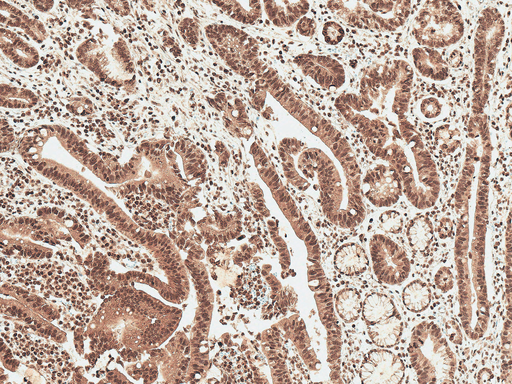 Ghrelin Antibody - Immunohistochemistry analysis using Rabbit Anti-Ghrelin Polyclonal Antibody. Tissue: Stomach. Species: Human. Fixation: Formalin Fixed Paraffin-Embedded. Primary Antibody: Rabbit Anti-Ghrelin Polyclonal Antibody  at 1:50 for 30 min at RT. Counterstain: Hematoxylin. Magnification: 10X. HRP-DAB Detection.