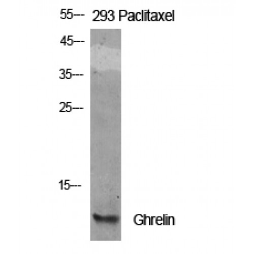 Ghrelin Antibody - Western blot of Ghrelin antibody