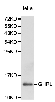 Ghrelin Antibody - Western blot analysis of extracts of HeLa cellss.