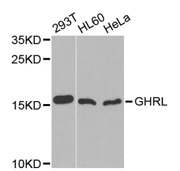 Ghrelin Antibody - Western blot analysis of extracts of various cell lines, using GHRL antibody at 1:1000 dilution. The secondary antibody used was an HRP Goat Anti-Rabbit IgG (H+L) at 1:10000 dilution. Lysates were loaded 25ug per lane and 3% nonfat dry milk in TBST was used for blocking. An ECL Kit was used for detection and the exposure time was 90s.