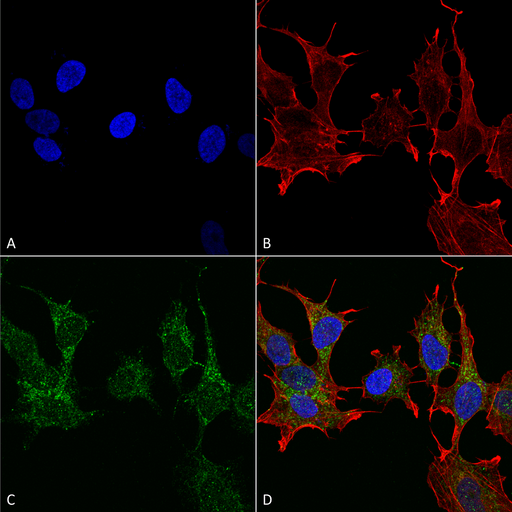 Ghrelin Antibody - Rabbit Anti-Ghrelin Antibody used in Immunocytochemistry/Immunofluorescence (ICC/IF) on Neuroblastoma cell line (SK-N-BE)