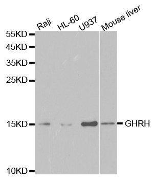 GHRH Antibody - Western blot analysis of extracts of various cell lines.