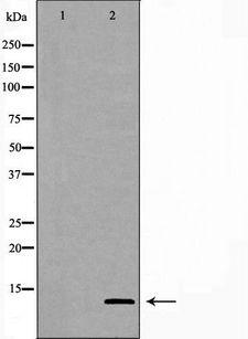 GHRH Antibody - Western blot analysis of HeLa cell lysates using GHRH antibody. The lane on the left is treated with the antigen-specific peptide.