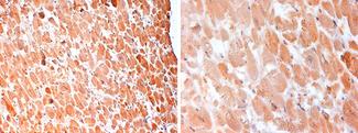 GHRH Antibody - Anti-Human GHRH staining (4 µg/ml) of a human heart formalin-fixed, paraffin-embedded tissue section; seen at 20x (left) and 40x (right) magnification. Cytoplasmic staining of myocytes is observed.