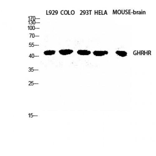 GHRHR Antibody - Western blot of GHRH-R antibody