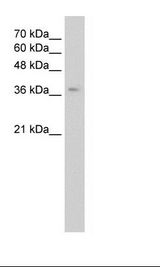 GHRHR Antibody - Jurkat Cell Lysate.  This image was taken for the unconjugated form of this product. Other forms have not been tested.