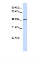 GHRHR Antibody - Placenta lysate. Antibody concentration: 1.0 ug/ml. Gel concentration: 12%.  This image was taken for the unconjugated form of this product. Other forms have not been tested.